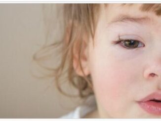 Everything about Allergic Conjunctivitis